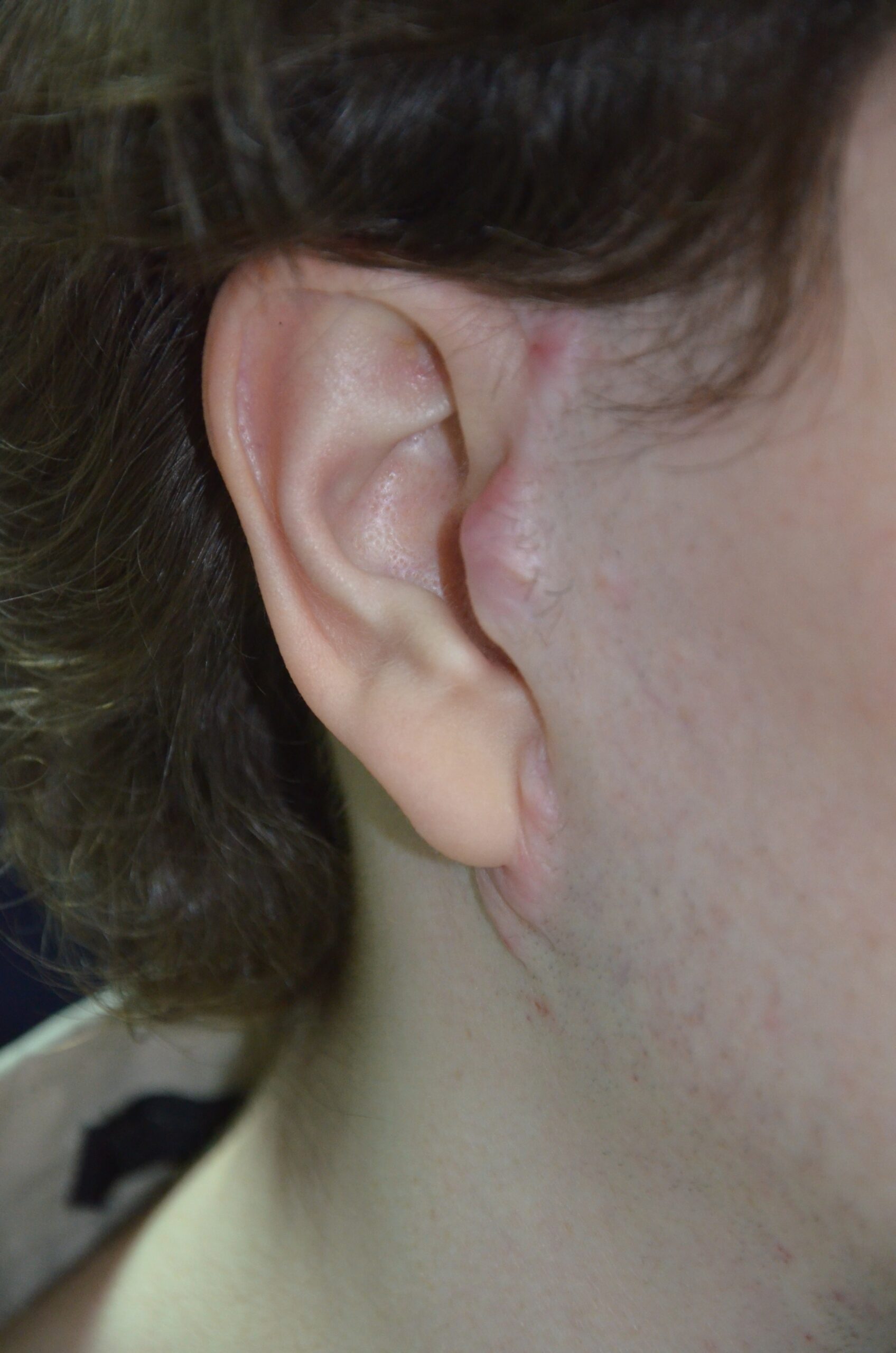 plastic surgeon rhinoplasty plastic surgeon rhinoplasty